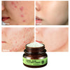 Vibrant Glamour Herbal Acne Treatment Cream 30g.